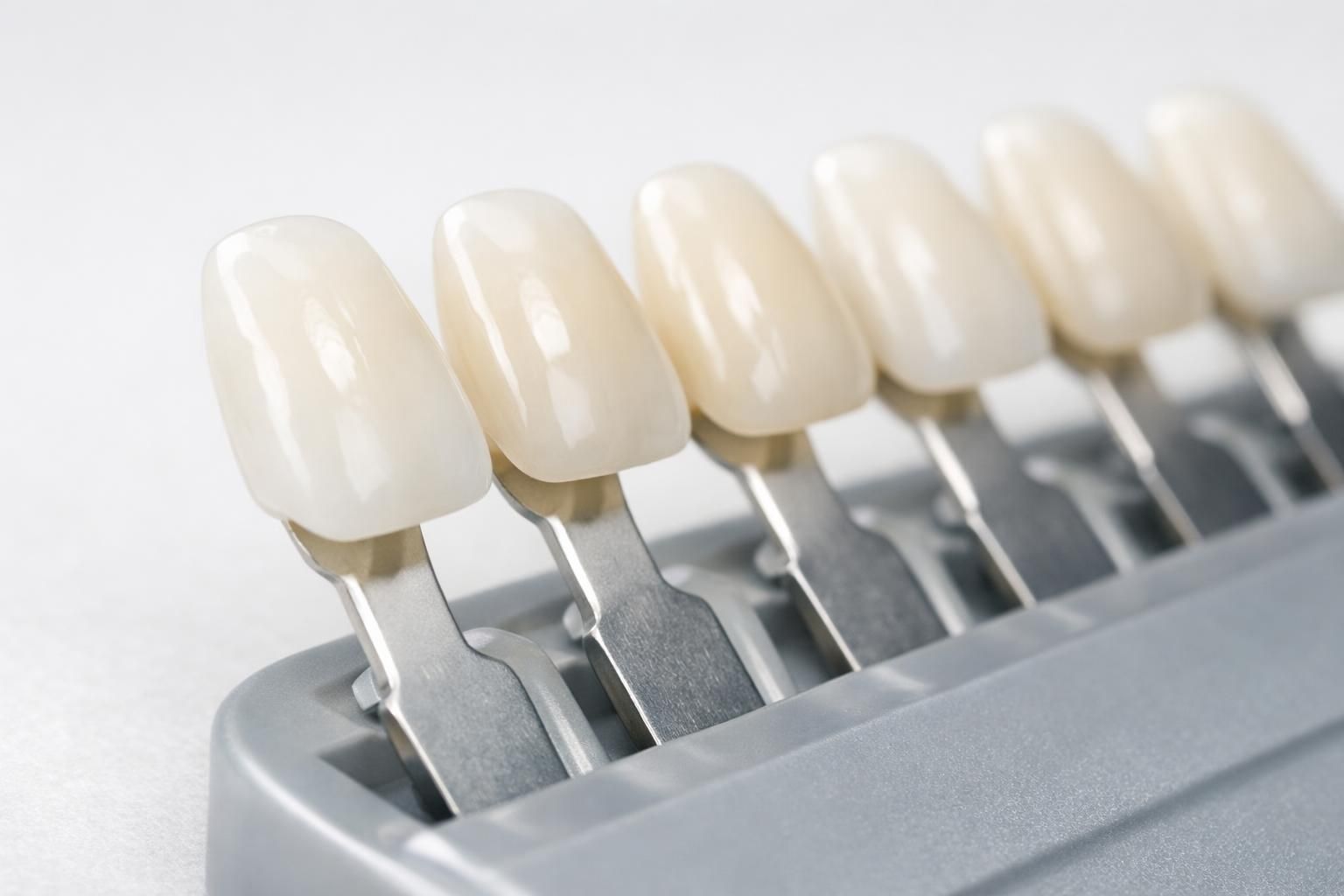 Nuancier de teintes dentaires posé sur une surface claire, détail clinique
