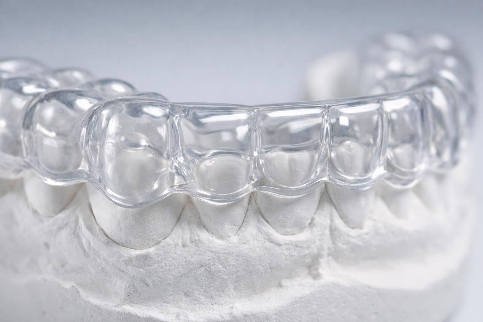 Gros plan d'une gouttière occlusale transparente posée sur un modèle dentaire