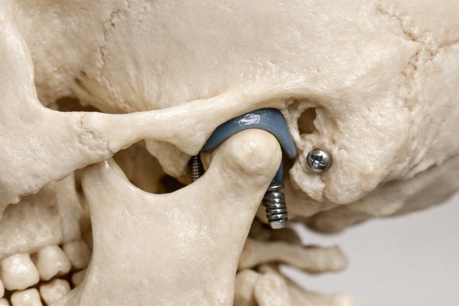 Zone de l'articulation de la mâchoire située juste devant l'oreille