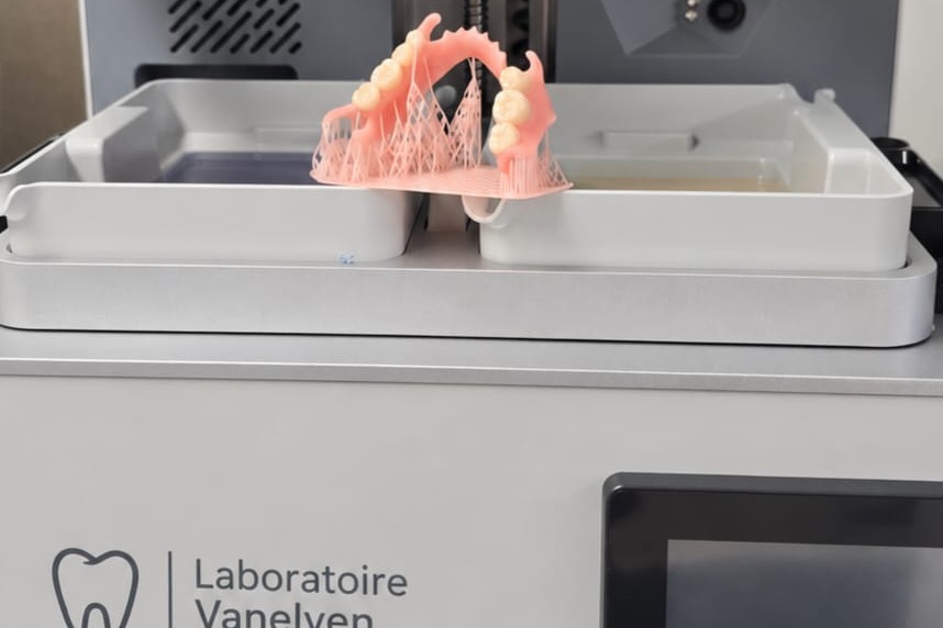 Prothèse dentaire imprimée en 3D dans l'imprimante du Laboratoire Vanelven